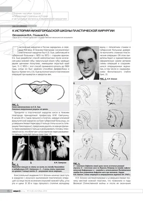 Ринопластика фото до и после - рейтинг хирургов и цены в Москве и России