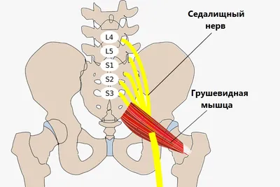 Болят зубы после установки брекетов - Cтоматология Май