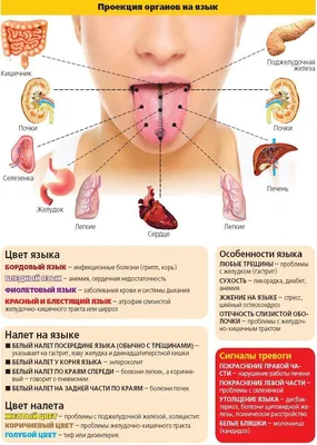 Как распознать болезни по языку: 10 симптомов, которые нельзя игнорировать  | DOCTORPITER