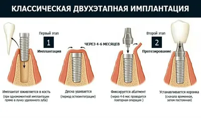 Болит, зудит или чешется: почему возникает дерматит и всегда ли виновна  аллергия? | О здоровье: с медицинского на русский | Дзен