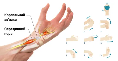 Болезни кистей рук: фото для пациентов