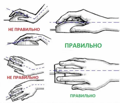 Болезни кистей рук: фото для диагностики