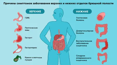 Болит живот или сердце? Абдоминальная форма инфаркта миокарда