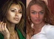 Отдавшая 19 миллионов за пластическую операцию Боня вновь обратилась к  косметологу :: Шоу-бизнес :: Дни.ру