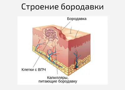 Бородавки на руках: фото-серия для диагностики