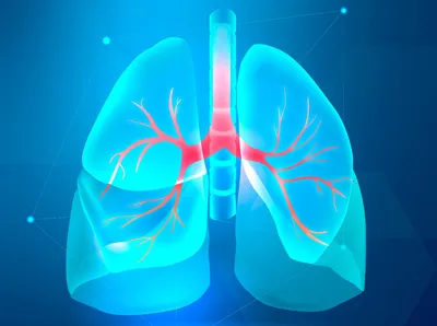 Бронхиальная астма - Феникс