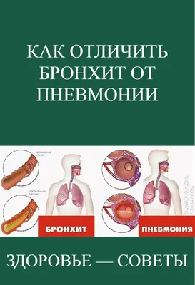 Бронхит: истории из жизни, советы, новости, юмор и картинки — Все посты,  страница 3 | Пикабу