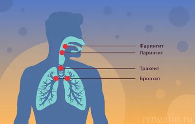 Бронхит | Клиника Добрый Доктор г. Красноярск