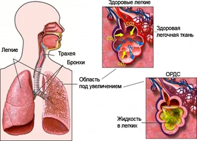 Что нужно знать о коронавирусе | Интересные факты в картинках | Дзен