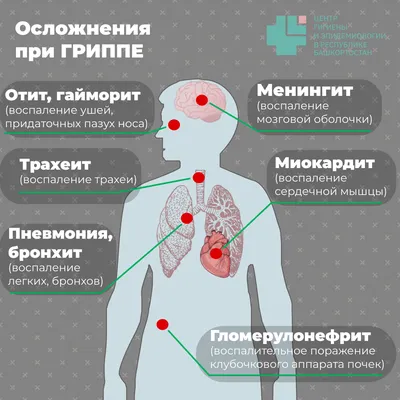 57 392 рез. по запросу «Бронхит» — изображения, стоковые фотографии,  трехмерные объекты и векторная графика | Shutterstock