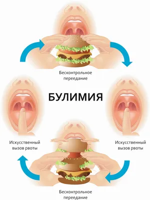 Булимия, как лечить самостоятельно?