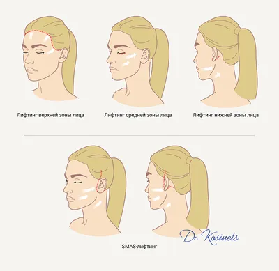 До и после пересадки нижней части лица | Пикабу