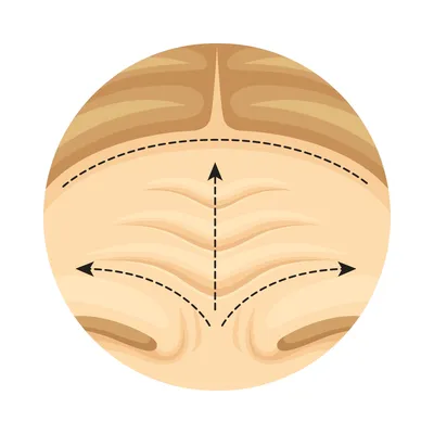 Омоложение шеи и нижней части лица — Украинская академия пластической  хирургии