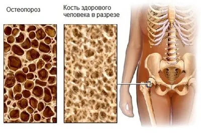 Рука человека в разрезе, анатомия» — создано в Шедевруме