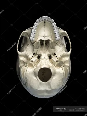 Фото черепа человека с золотыми украшениями