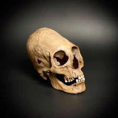 Изображение черепа человека сбоку