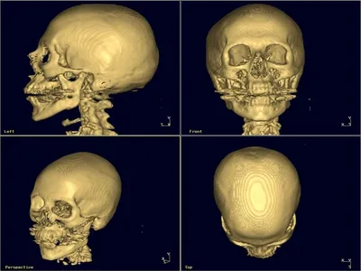 Фотография черепа человека на черном фоне в формате JPG