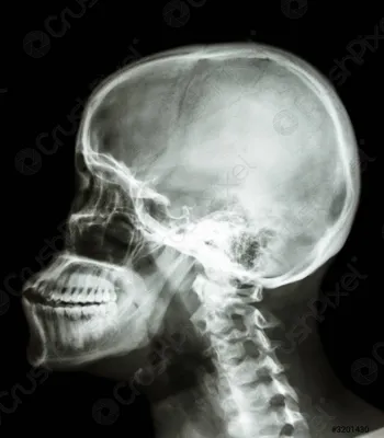 Фотография черепа человека на белом фоне