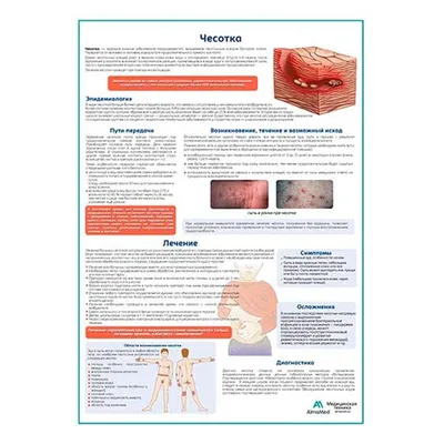 Чесотка в картинках фотографии