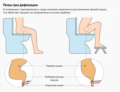 Почему не стоит долго сидеть в туалете в Малайзии (4 фото) » Невседома