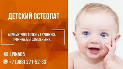 Фотография черепа ребенка с аномалией Шишкина