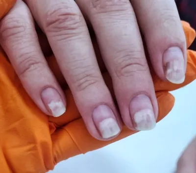 Какие витамины и минералы помогают сохранить здоровье ногтей на руках: фото-иллюстрации