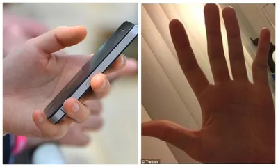 Изображение рук с деформацией пальцев
