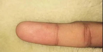 Деформированные пальцы на фото для медицинского обучения
