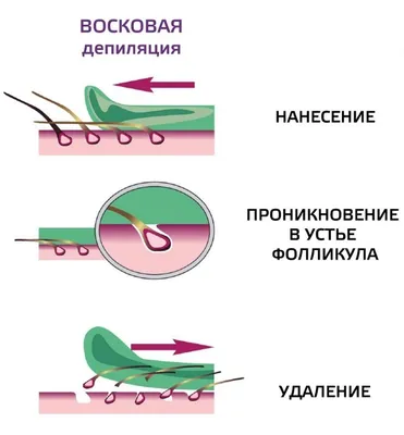 Визуал Шугаринг | Шугаринг, Восковая депиляция, Восковая депиляция ног