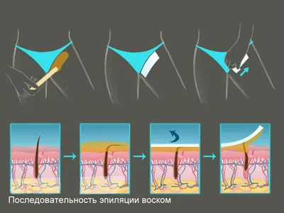 Депиляция воском в Москве, Химках, Красногорске, Жуковском