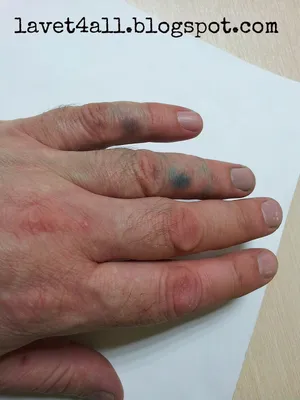 Фото дерматита кожи рук в формате JPG