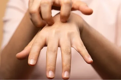 Фото дерматита на пальцах рук: как правильно ухаживать