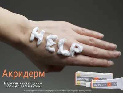 Фотография рук с дерматитом в WebP для быстрой загрузки