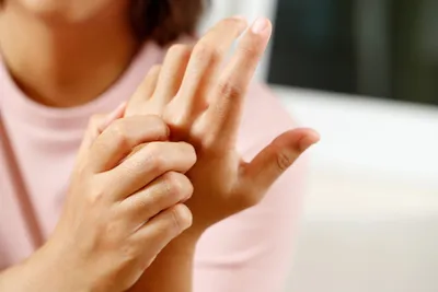 Изображение дерматита на руках с подписью о причинах заболевания