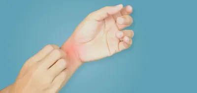 Фото дерматита на руке с пузырьками
