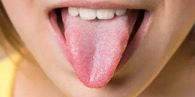 Как распознать болезни по языку: 10 симптомов, которые нельзя игнорировать  | DOCTORPITER