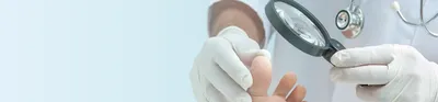 Фотография руки с дрожжевым грибком на ногтях и негативным влиянием на окружающих