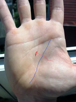 Детальное фото руки с двумя линиями жизни