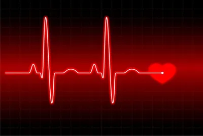 ЭКГ – диагностика состояния сердца. Показания к ЭКГ, что показывает  исследование. Как делают ЭКГ