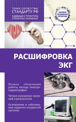 Электрокардиография (ЭКГ) в медицинском центре МедЭлит | Сделать ЭКГ в  Москве