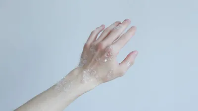 Фото экземы на пальцах: советы по уходу за кожей