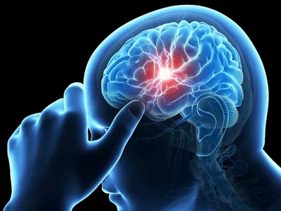 Эпилепсия | Курсы первой помощи