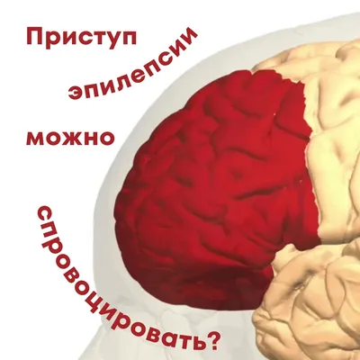 Эпилепсия - это должен знать каждый! — Мурманская Областная Клиническая  Больница им. П. А. Баяндина