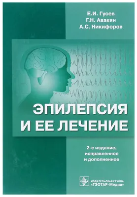 эпилепсия — Санкт-Петербургское государственное бюджетное учреждение  здравоохранения «Городская поликлиника № 78»