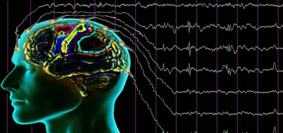 КТ при эпилепсии | Пикабу