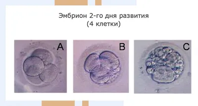 Беременность. Развитие плода