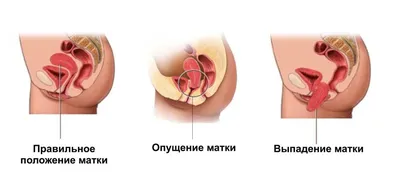 Матка человека — Википедия