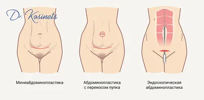 Эмбриональное развитие, подготовка к ЕГЭ по биологии