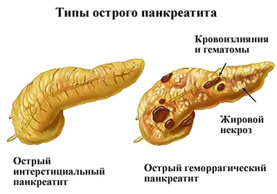 Пищеварительные ферменты НСП ☘ купить по низкой цене в Киеве и Украине -  сайт продукции компании NSP