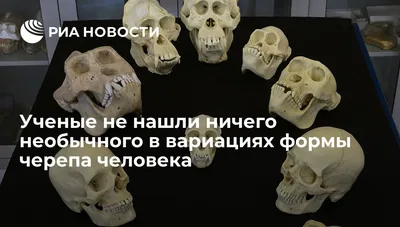 Фото черепа человека в разных ракурсах